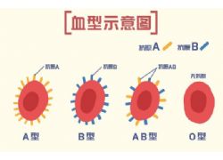 研究發(fā)現(xiàn)血型與疾病的發(fā)生有相關性